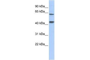 WB Suggested Anti-KLHL8 Antibody Titration:  0. (KLHL8 抗体  (Middle Region))