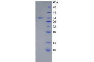 SDS-PAGE analysis of Human Laminin gamma 1 Protein. (Laminin gamma 1 蛋白)