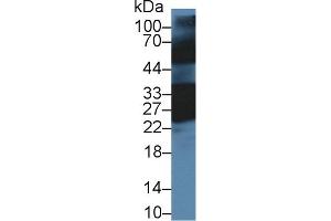 Detection of CRYbB1 in Mouse Eye lysate using Polyclonal Antibody to Crystallin Beta B1 (CRYbB1)