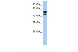 Image no. 1 for anti-Vimentin (VIM) (AA 110-159) antibody (ABIN6738431) (Vimentin 抗体  (AA 110-159))