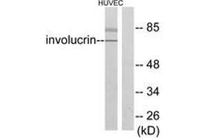 Western blot analysis of extracts from HuvEc cells, using Involucrin Antibody. (Involucrin 抗体  (AA 536-585))