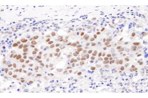 anti-General Transcription Factor III (GTF2I) (C-Term) antibody