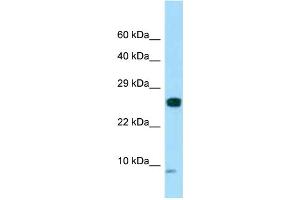 WB Suggested Anti-SPANXC Antibody Titration: 1. (SPANXC 抗体  (N-Term))
