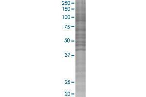 KLF15 transfected lysate. (KLF15 293T Cell Transient Overexpression Lysate(Denatured))