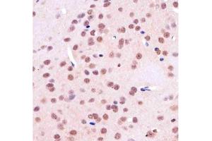 Immunohistochemistry (IHC) image for anti-TATA Box Binding Protein (TBP) antibody (ABIN3029100)
