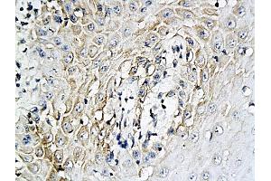 Antigen: 2 µg/100 µL  Primary: Antiserum, 1:500, 1:1000, 1:2000, 1:4000, 1:8000, 1:16000, 1:32000;  Secondary: HRP conjugated Rabbit Anti-Goat IgG at 1: 5000;  TMB staining  Read the data in Microplate Reader by 450nm. (IL-6 抗体  (AA 110-185))