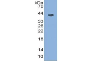 Western Blotting (WB) image for Complement 4 (C4) ELISA Kit (ABIN6574234)