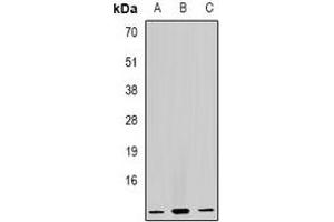 Western blot analysis of GHRH expression in Raji (A), HL60 (B), mouse liver (C) whole cell lysates. (GHRH 抗体)