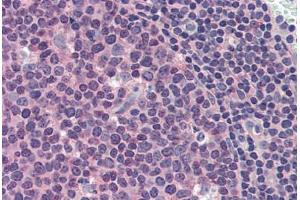 Human Tonsil (formalin-fixed, paraffin-embedded) stained with MCL1 antibody ABIN337283 at 10 ug/ml followed by biotinylated anti-mouse IgG secondary antibody ABIN481714, alkaline phosphatase-streptavidin and chromogen. (MCL-1 抗体)