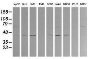 Image no. 1 for anti-Mitogen-Activated Protein Kinase Kinase 1 (MAP2K1) antibody (ABIN1499390) (MEK1 抗体)
