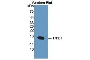 Western Blotting (WB) image for anti-Cartilage Oligomeric Matrix Protein (COMP) (AA 123-240) antibody (ABIN1867326) (COMP 抗体  (AA 123-240))