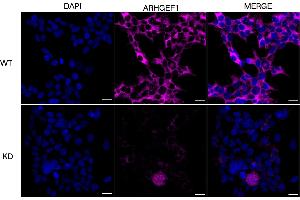 Immunocytochemical staining of HeLa cells using ARHGEF1 antibody (ABIN7800200), 1:1,000), Top panel: wild-type (WT), Bottom panal: ARHGEF1 shRNA knockdown (KD).