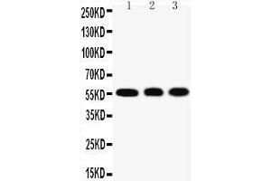 Anti-KLF4 antibody, Western blotting Lane 1: HELA Cell Lysate Lane 2: A549 Cell Lysate Lane 3: U20S Cell Lysate