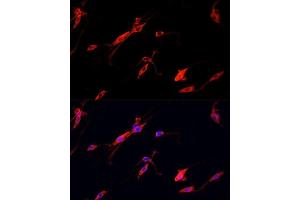 Immunofluorescence analysis of PC12 cells using ENO2 antibody. (ENO2/NSE 抗体  (AA 195-434))