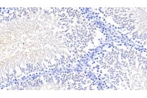 Detection of Kim1 in Rat Testis Tissue using Monoclonal Antibody to Kidney Injury Molecule 1 (Kim1) (HAVCR1 抗体  (AA 22-235))