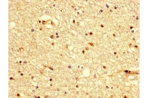 IHC image of ABIN7145183 diluted at 1:300 and staining in paraffin-embedded human brain tissue performed on a Leica BondTM system. (BDKRB2 抗体  (AA 336-391))