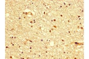 IHC image of ABIN7145183 diluted at 1:300 and staining in paraffin-embedded human brain tissue performed on a Leica BondTM system. (BDKRB2 抗体  (AA 336-391))