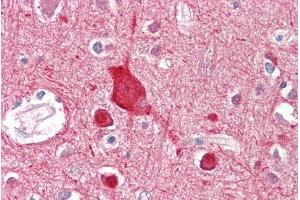 Immunohistochemistry (IHC) image for anti-ATP-Binding Cassette, Sub-Family A (ABC1), Member 2 (ABCA2) (Internal Region) antibody (ABIN263228)