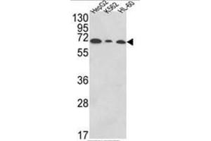 Western blot analysis of PIGR Antibody (C-term) in HepG2,K562,HL-60 cell line lysates (35ug/lane). (PIGR 抗体  (C-Term))