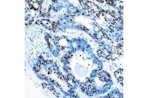 Immunohistochemistry (IHC) image for anti-Retinoblastoma Binding Protein 5 (RBBP5) antibody (ABIN7308262) (RBBP5 抗体)