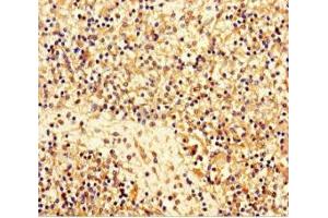 Immunohistochemistry of paraffin-embedded human spleen tissue using ABIN7159348 at dilution of 1:100 (Majin (AA 1-216) 抗体)