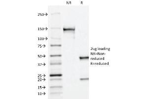 SDS-PAGE Analysis Purified PSAP Mouse Monoclonal Antibody (ACPP/1338). (ACPP 抗体)