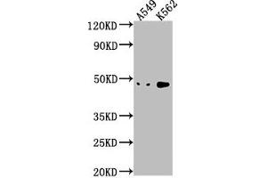 Western Blot Positive WB detected in: A549 whole cell lysate, K562 whole cell lysate All lanes: NKAPL antibody at 1:1000 Secondary Goat polyclonal to rabbit IgG at 1/50000 dilution Predicted band size: 47 kDa Observed band size: 47 kDa (NKAPL 抗体  (AA 114-123))