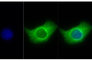 Immunofluorescence (IF) image for anti-Tubulin, beta (TUBB) (AA 170-419) antibody (ABIN7428962)