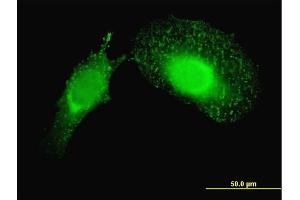 Immunofluorescence of monoclonal antibody to PDCD6IP on HeLa cell. (ALIX 抗体  (AA 1-110))
