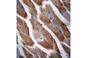 Immunohistochemistry analysis in formalin fixed and paraffin embedded human skeletal muscle reacted with Matrilin-1 Antibody (C-term) followed which was peroxidase conjugated to the secondary antibody and followed by DAB staining.