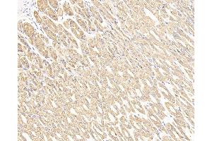 Immunohistochemistry analysis of paraffin-embedded mouse stomach cancer using CK-7 Monoclonal Antibody at dilution of 1:300. (Cytokeratin 7 抗体)