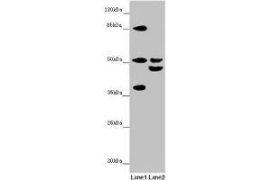 Western blot All lanes: NYX antibody at 7. (Nyctalopin 抗体  (AA 282-481))