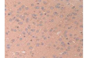 Detection of ANGPTL2 in Mouse Brain Tissue using Polyclonal Antibody to Angiopoietin Like Protein 2 (ANGPTL2) (ANGPTL2 抗体  (AA 267-493))
