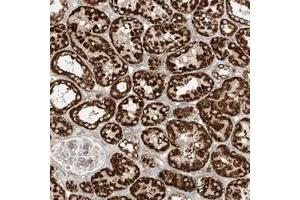 Immunohistochemical staining of human kidney with PLCL1 polyclonal antibody  shows strong cytoplasmic positivity, with a granular pattern in renal tubular cells at 1:200-1:500 dilution. (PLCL1 抗体)