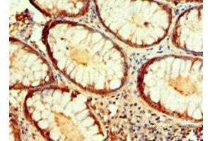 Immunohistochemistry (IHC) image for anti-Isocitrate Dehydrogenase 1 (NADP+), Soluble (IDH1) (AA 1-240) antibody (ABIN6097760)