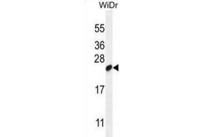 Western Blotting (WB) image for anti-Chromosome 19 Open Reading Frame 84 (C19orf84) antibody (ABIN2995151) (C19orf84 抗体)