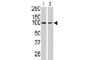 The KIT polyclonal antibody  is used in Western blot to detect KIT in serum-starved HeLa cell lysate (lane 1) and primate testis tissue lysate (lane 2) . (KIT 抗体  (N-Term))