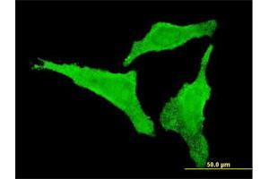 Immunofluorescence of monoclonal antibody to CDKL2 on HeLa cell. (CDKL2 抗体  (AA 394-493))