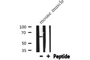 Western Blotting (WB) image for anti-Calreticulin (CALR) (N-Term) antibody (ABIN6256980)