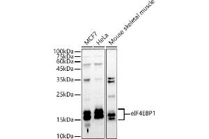 Western blot analysis of extracts of various cell lines, using eIF4EBP1 antibody (ABIN3021843, ABIN3021844, ABIN3021845 and ABIN1512858) at 1:1000 dilution. (eIF4EBP1 抗体  (C-Term))