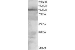 Image no. 1 for anti-Vav 2 Guanine Nucleotide Exchange Factor (VAV2) (Internal Region) antibody (ABIN374176) (VAV2 抗体  (Internal Region))