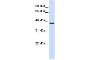 WB Suggested Anti-RASSF7 Antibody Titration: 0. (RASSF7 抗体  (Middle Region))