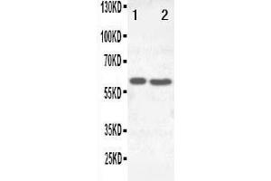 Western Blotting (WB) image for anti-Solute Carrier Family 22 Member 6 (SLC22A6) (AA 534-550), (C-Term) antibody (ABIN3044261)