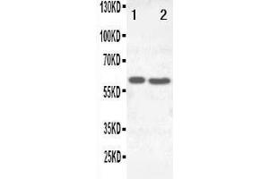 Anti-SLC22A6 antibody, Western blotting Lane 1:  Cell Lysate Lane 2: HELA Cell Lysate (SLC22A6 抗体  (C-Term))