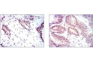 Immunohistochemistry (IHC) image for anti-Yes-Associated Protein 1 (YAP1) antibody (ABIN1109527) (YAP1 抗体)