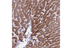 Immunohistochemical staining of human liver with KNCN polyclonal antibody  shows strong cytoplasmic positivity in hepatocytes at 1:50-1:200 dilution. (Kinocilin 抗体)