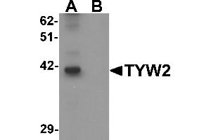 Western blot analysis of TYW2 in K562 cell lysate with TYW2 antibody at 0. (TRMT12 抗体  (N-Term))