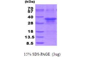 SDS-PAGE (SDS) image for Zinc Finger, AN1-Type Domain 5 (ZFAND5) (AA 1-213) protein (His tag) (ABIN5854034) (ZFAND5 Protein (AA 1-213) (His tag))