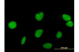Immunofluorescence of purified MaxPab antibody to ZNF573 on HeLa cell. (ZNF573 抗体  (AA 1-645))