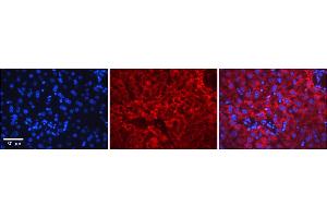 Rabbit Anti-ERCC8 Antibody    Formalin Fixed Paraffin Embedded Tissue: Human Adult liver  Observed Staining: Cytoplasmic,Nuclear Primary Antibody Concentration: 1:600 Secondary Antibody: Donkey anti-Rabbit-Cy2/3 Secondary Antibody Concentration: 1:200 Magnification: 20X Exposure Time: 0. (ERCC8 抗体  (N-Term))
